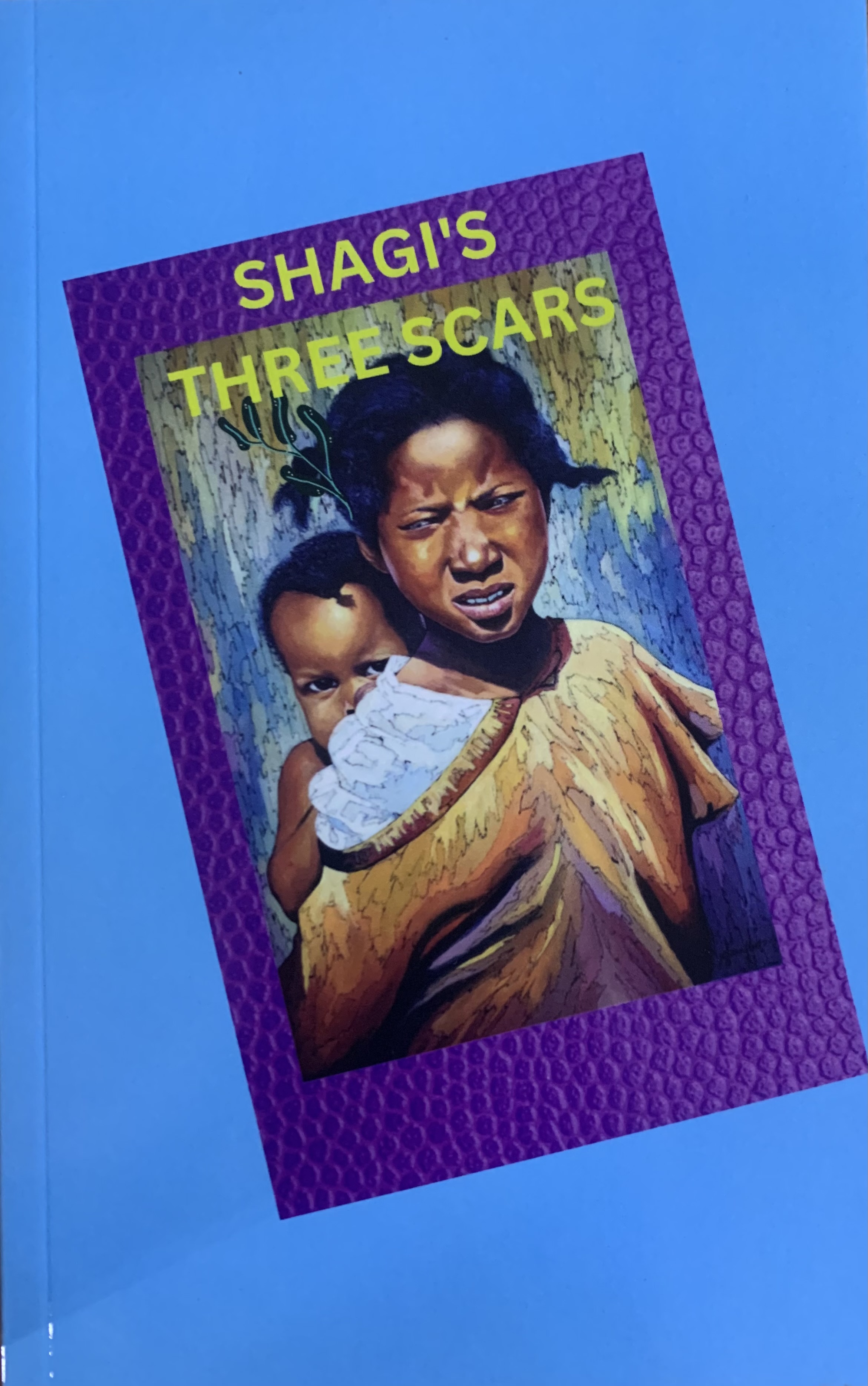 SHAGI'S THREE SCARS